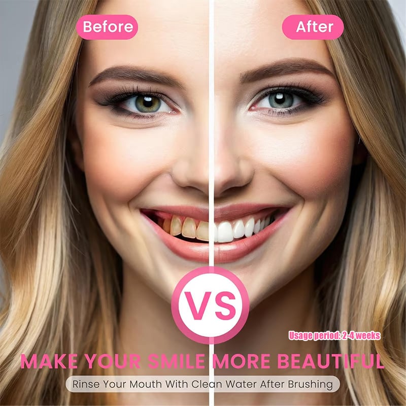 Niacinamide Whitening Toothpaste - For Healthier & Whiter Teeth!