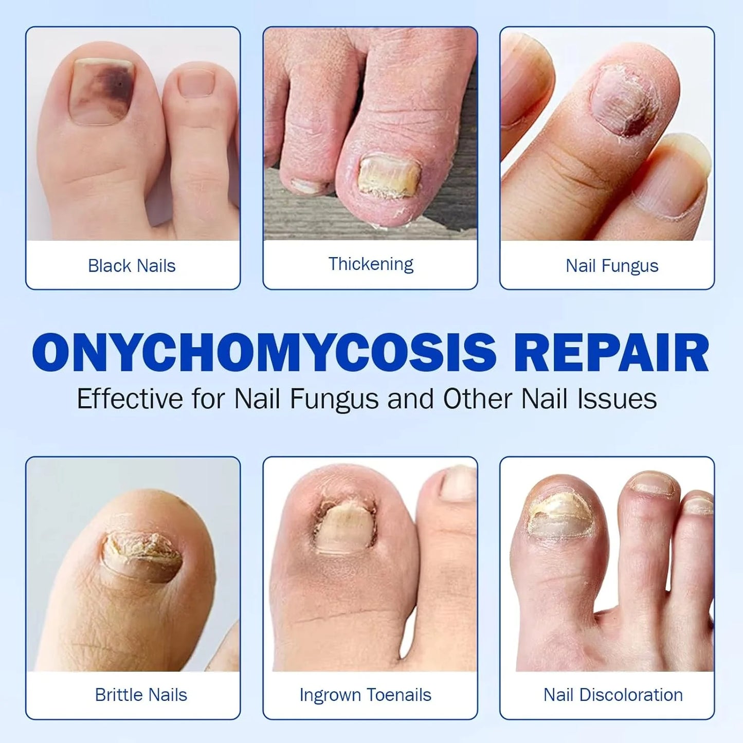 Nighttime Renewal Fungal Nail Patches