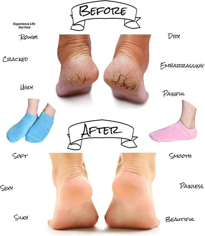 Moisturizing Spa Gel Socks (Imported)